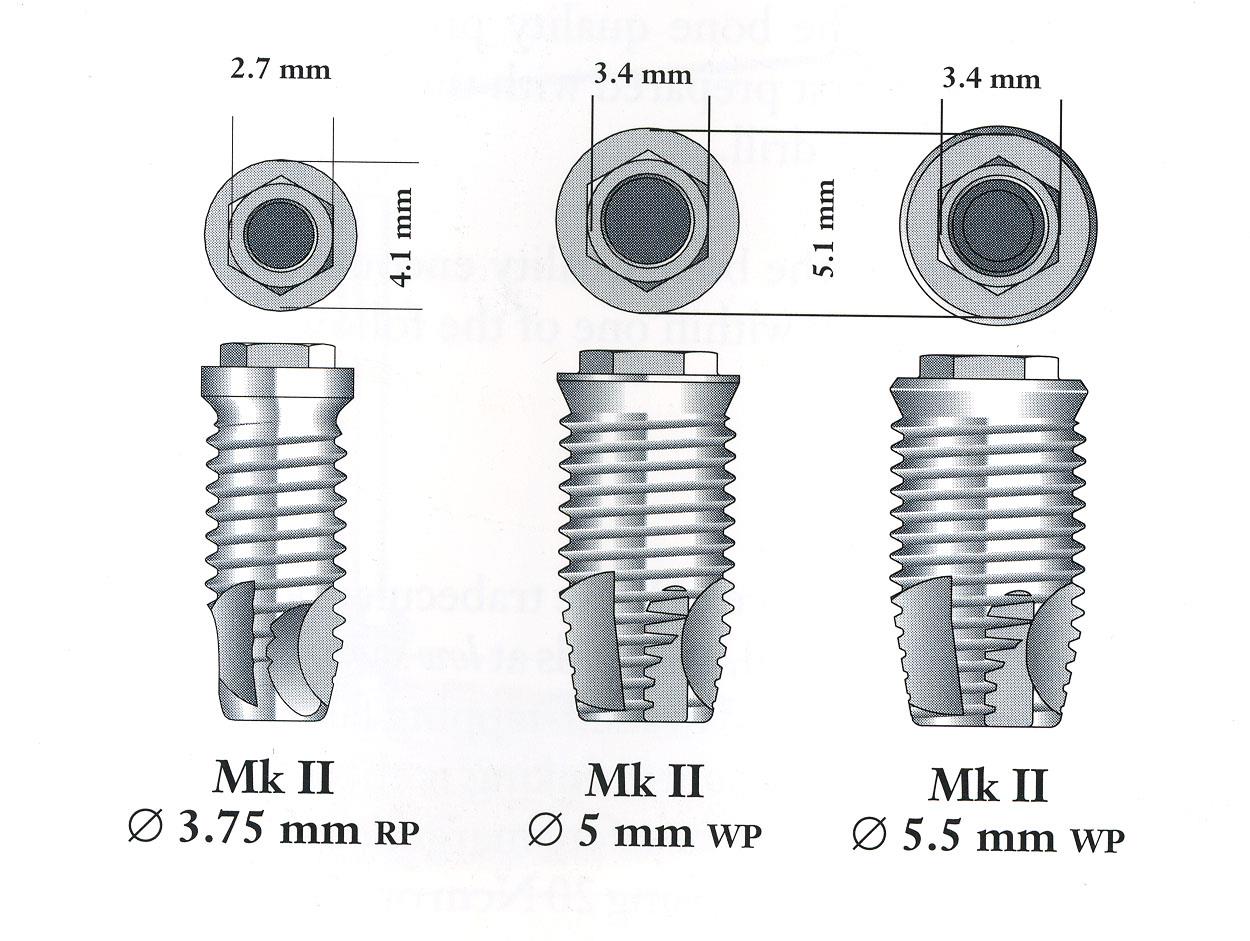 Nobel Biocare Branemark System MK II (Regular) Implant dentaire