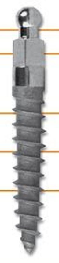 MDE main image
