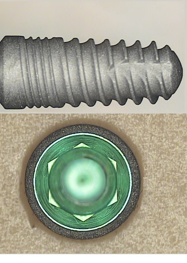 Implant Direct Legacy 2 Implant dentaire SpotImplant