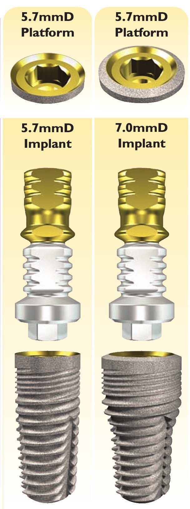 Implant Direct Legacy 2 Implant dentaire SpotImplant