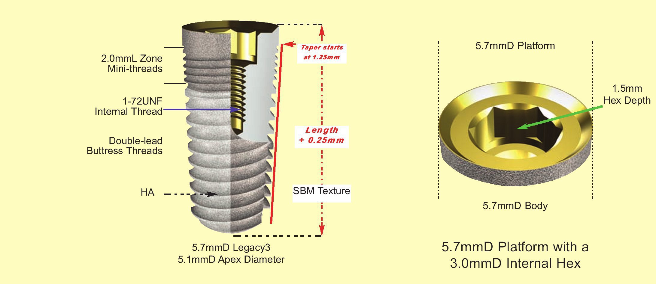 Implant Direct Legacy 2 Implant dentaire SpotImplant