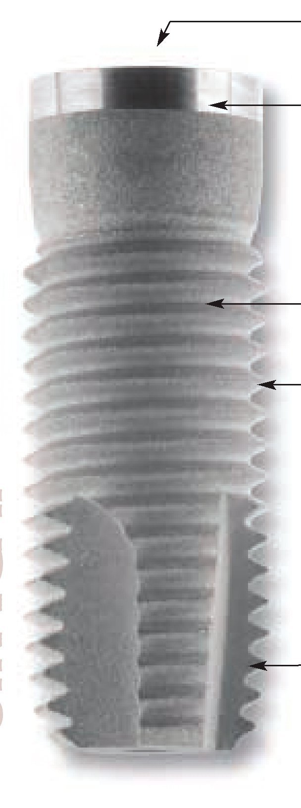 Keystone Dental (Lifecore Biomedical) Renova Straight Implant dentaire