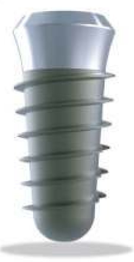 J2I main image