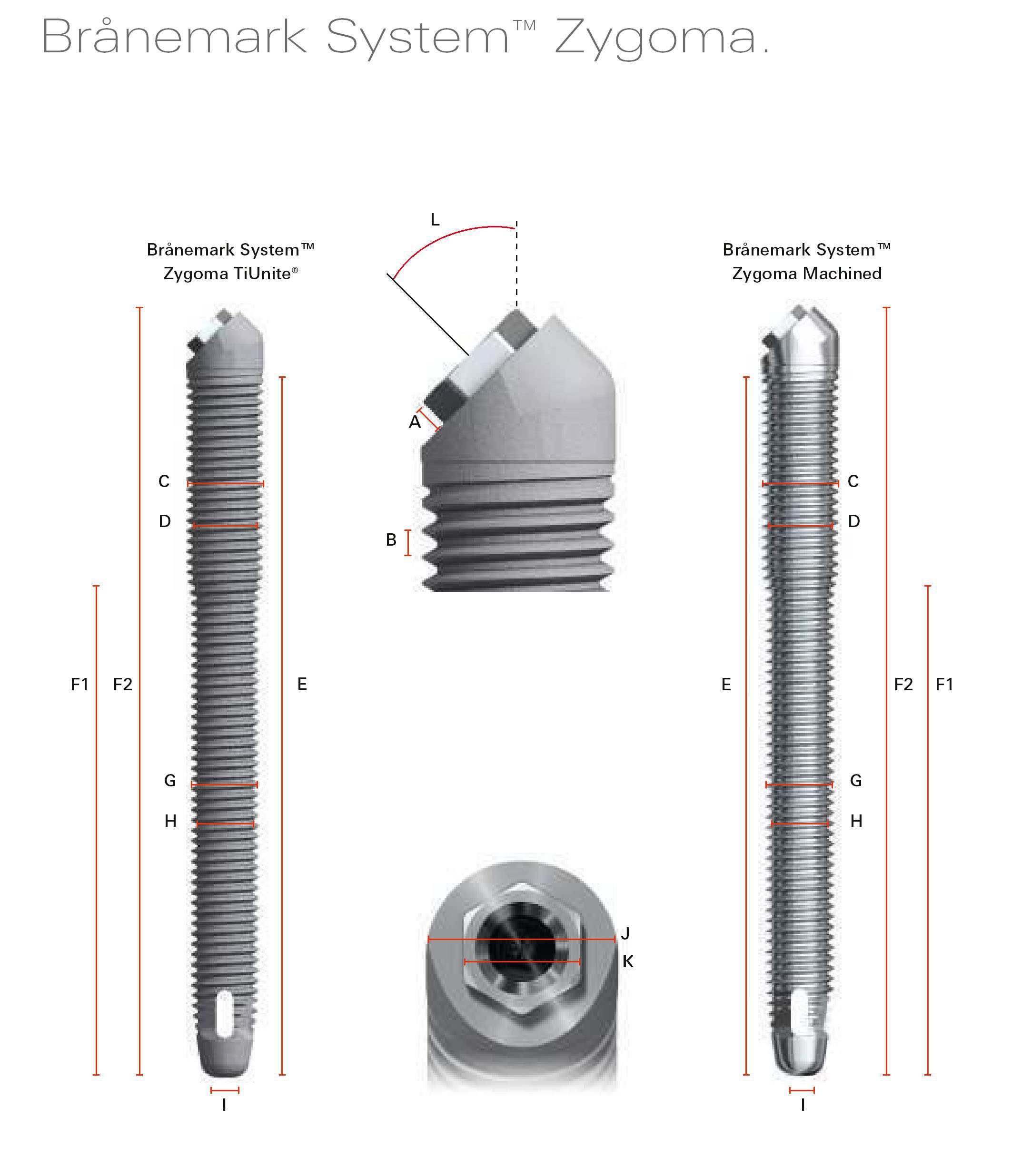 Nobel Biocare Brånemark System Zygoma Implant dentaire | SpotImplant