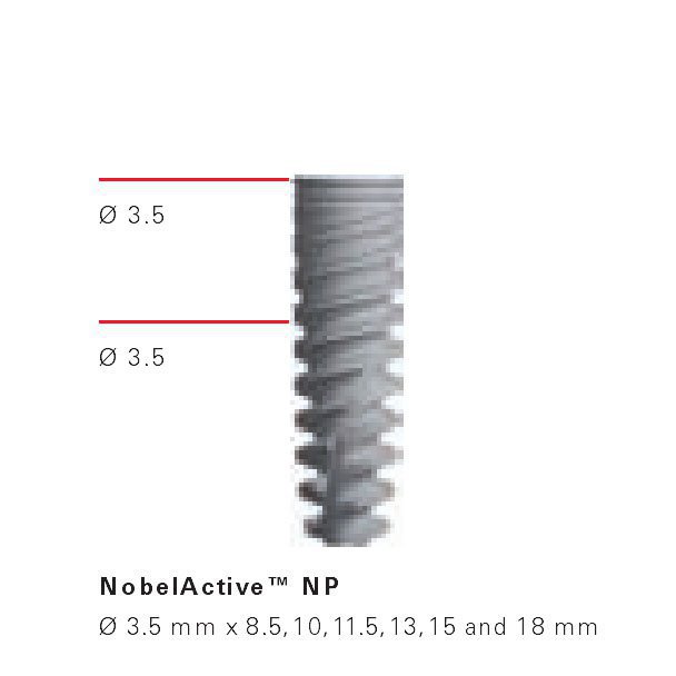 Nobel Biocare NobelActive Zahnimplantat SpotImplant