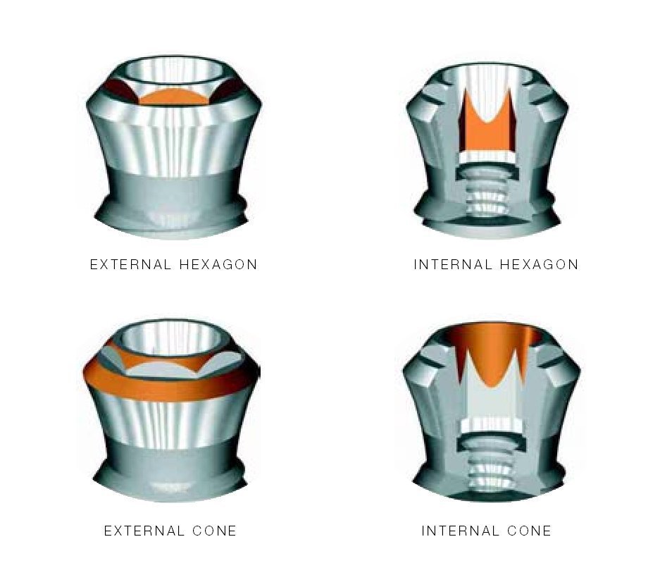 Phibo TSA Advance Implant dentaire SpotImplant