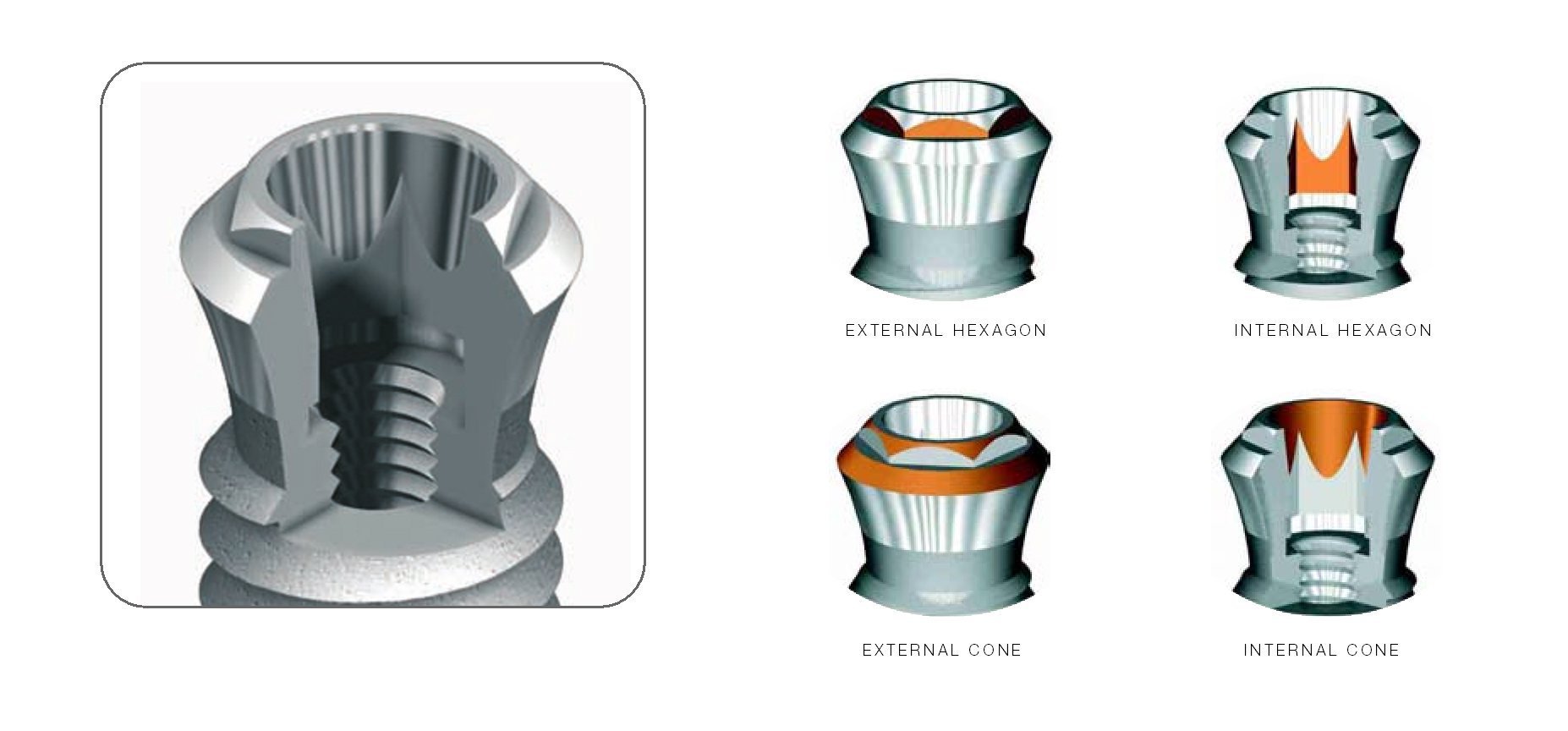 Phibo TSA Implant dentaire SpotImplant