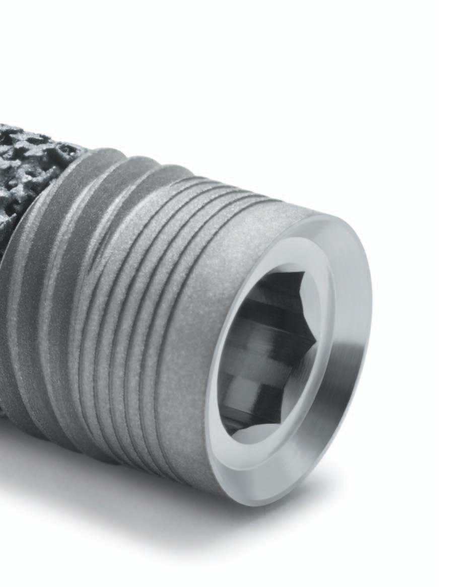 Zimmer-Biomet Trabecular Metal Implant dentaire | SpotImplant