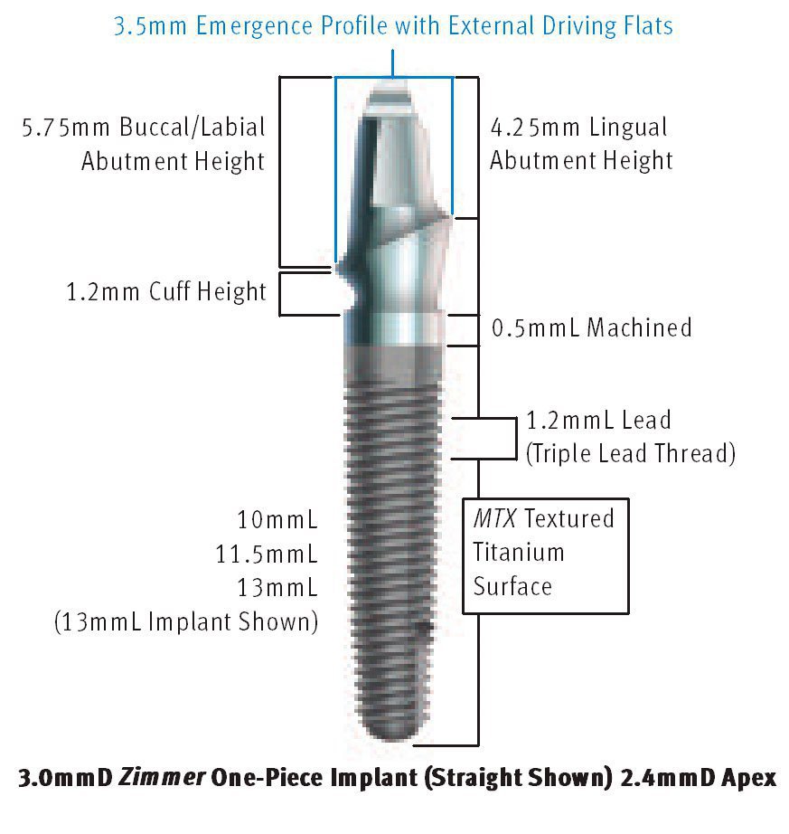 Zimmer OnePiece Implant Impianto dentale SpotImplant