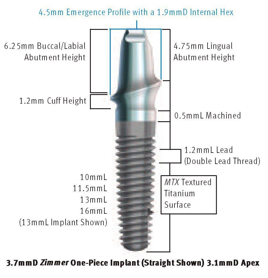 What is zimmer implant, Zimmer Biomet Dental Implants